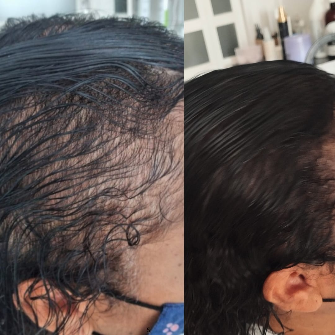 Cabelo da mesma cliente após o tratamento capilar em Jundiaí.